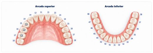 Mapa de aparatología de ortodoncia en DentalSoft